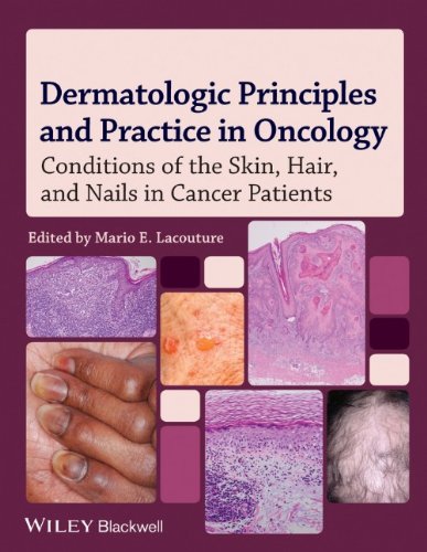 Dermatology and the Cancer Patient