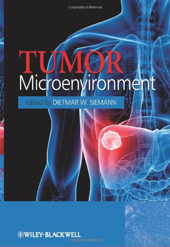 Tumor microenvironment