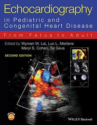 Echocardiography in Pediatric and Congenital Heart Disease