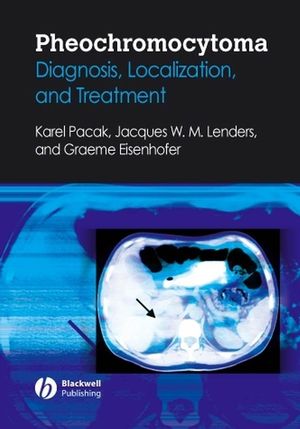 Pheochromocytoma : diagnosis, localization, and treatment