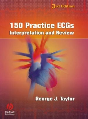 150 Practice ECGs : interpretation and review