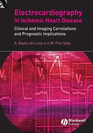 The surface electrocardiography in ischaemic heart disease : clinical and imaging correlations and prognostic implications