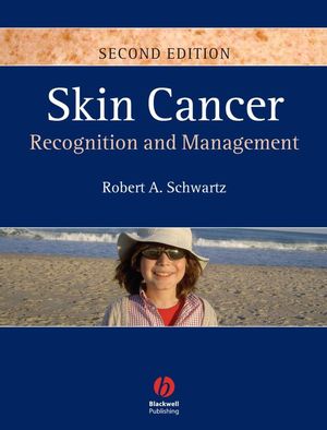 Skin cancer : recognition and management