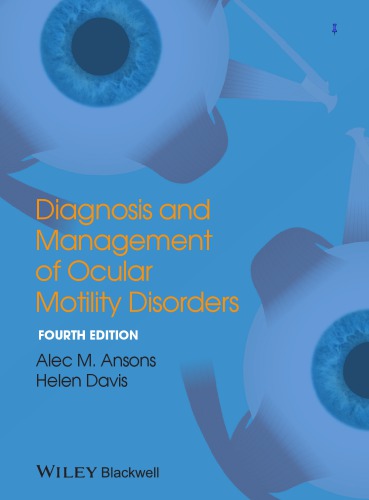 Diagnosis and management of ocular motility disorders