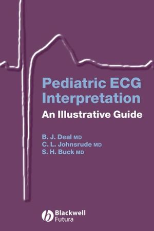 Pediatric ECG interpretation : an illustrative guide