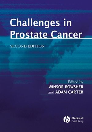 Challenges in prostate cancer