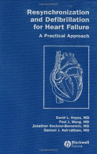Resynchronization and Defibrillation for Heart Failure