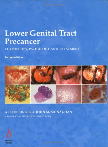 Lower Genital Tract Precancer