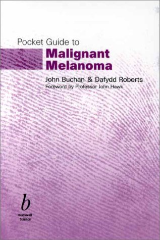 Pocket Guide to Malignant Melanoma