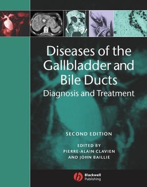 Diseases of the gallbladder and bile ducts : diagnosis and treatment