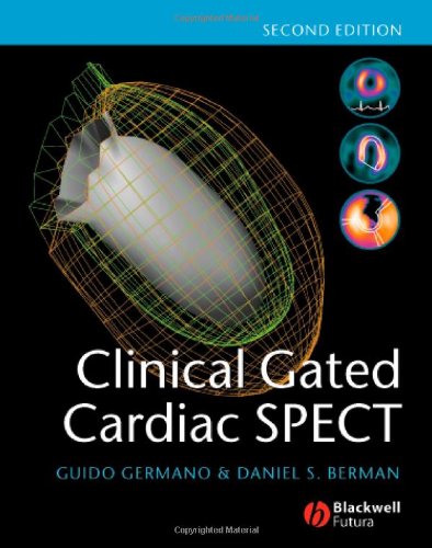 Clinical Gated Cardiac Spect