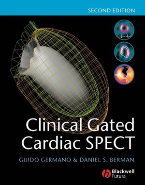 Clinical gated cardiac SPECT