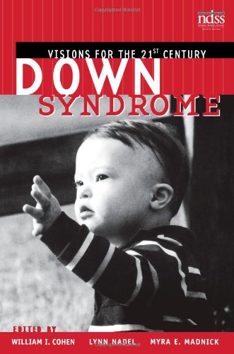 Down Syndrome