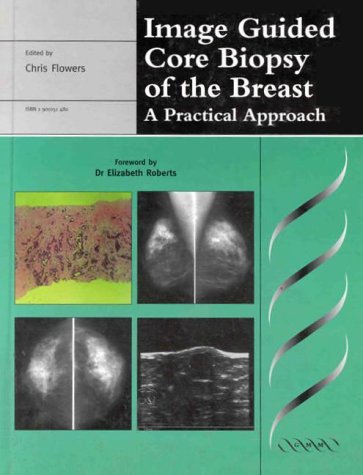 Image guided core biopsy of the breast : a practical approach