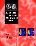 Magnetic resonance imaging in stroke