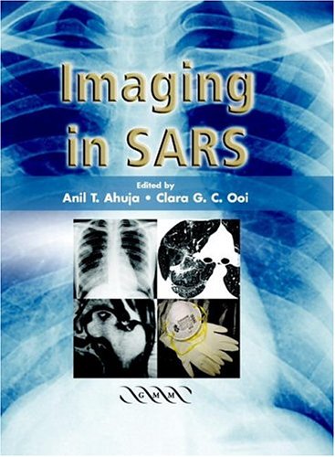 Imaging in SARS