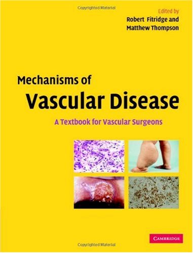 Mechanisms of vascular disease : a textbook for vascular surgeons