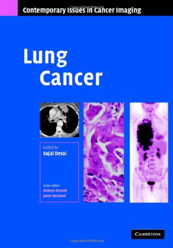 Lung Cancer