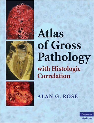 Atlas of Gross Pathology