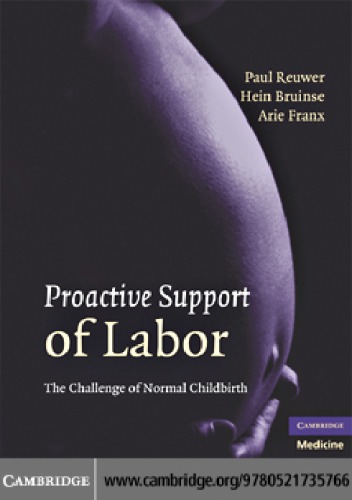 Proactive Support of Labor