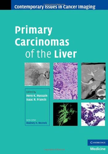 Primary carcinomas of the liver