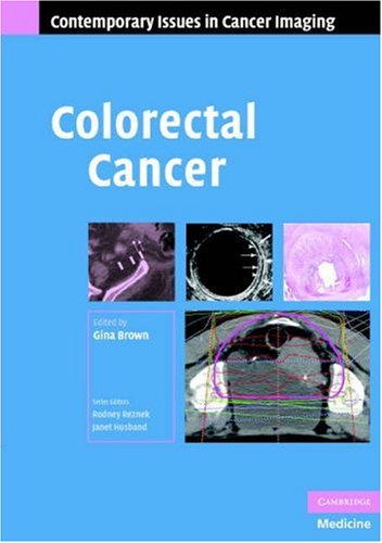 Colorectal Cancer