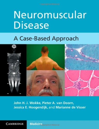Neuromuscular Disease