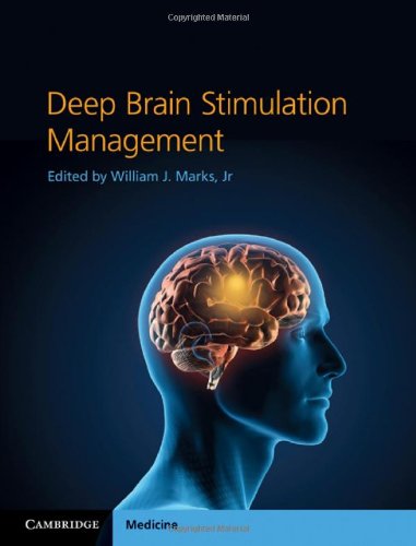 Deep Brain Stimulation Management