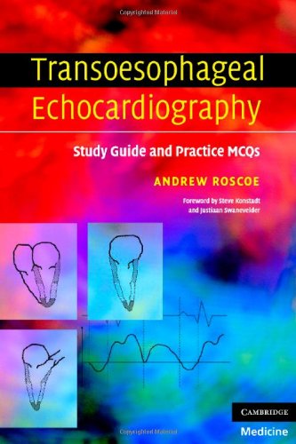 Transoesophageal Echocardiography