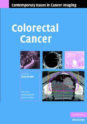 Colorectal Cancer (Contemporary Issues in Cancer Imaging)