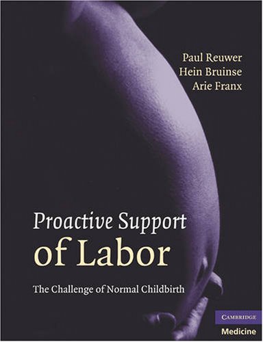 Proactive Support of Labor