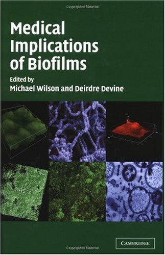 Medical Implications of Biofilms