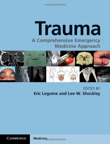 Trauma