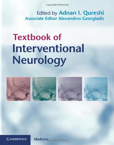 Interventional Neurology