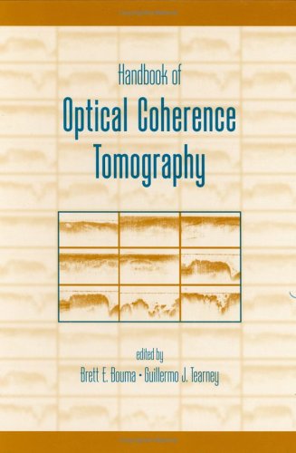 Handbook of optical coherence tomography