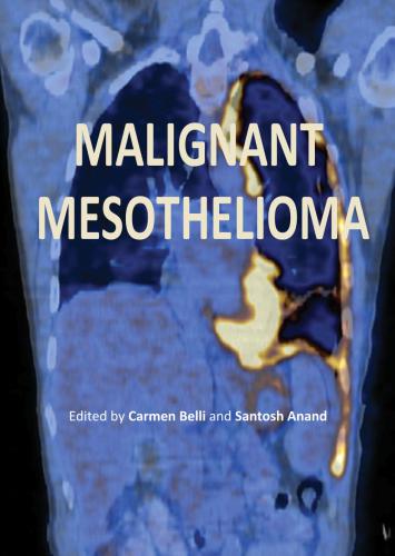 Malignant Mesothelioma