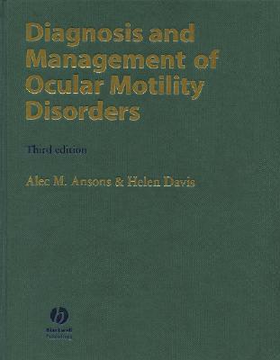 Diagnosis and Management of Ocular Motility Disorders