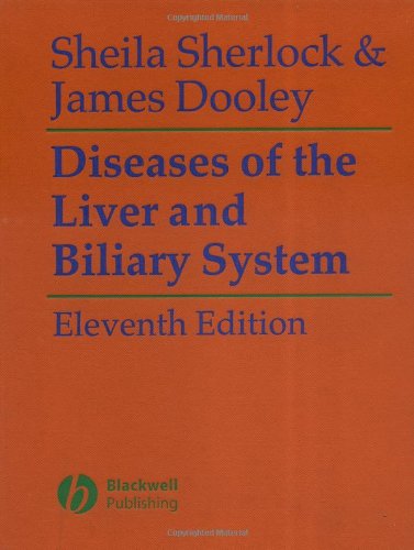 Diseases Of The Liver And Biliary System