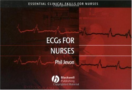 ECGs for Nurses