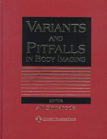 Variants and Pitfalls in Body Imaging