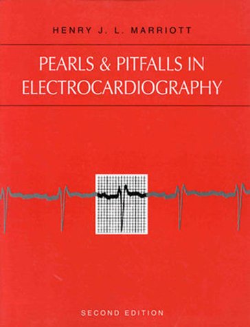 Pearls &amp; Pitfalls In Electrocardiography