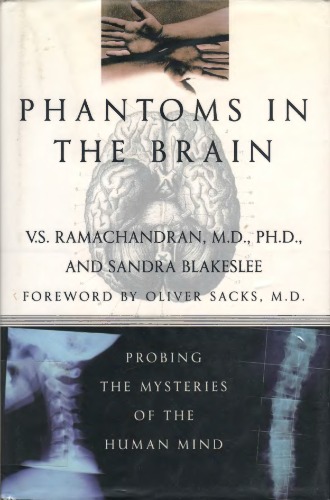 Phantoms in the Brain