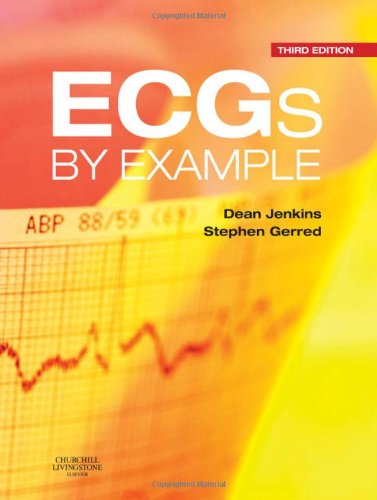 Ecgs by Example