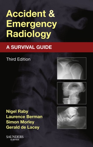 Accident and Emergency Radiology