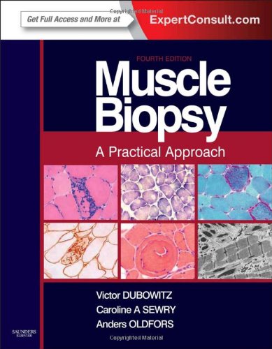 Muscle Biopsy