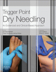 Trigger Point Dry Needling