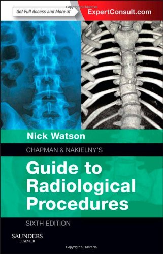 Chapman &amp; Nakielny's Guide to Radiological Procedures