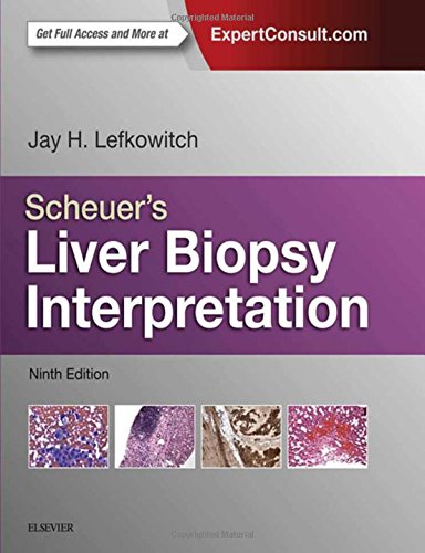 Scheuer's Liver Biopsy Interpretation