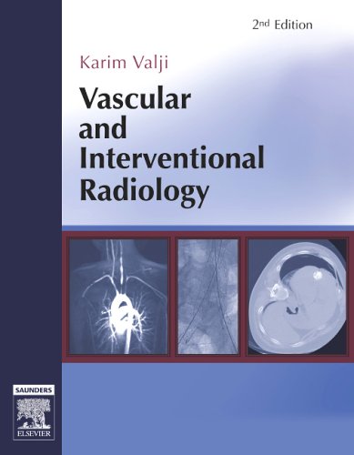 Vascular and Interventional Radiology