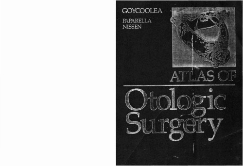 Atlas Of Otologic Surgery